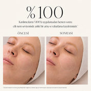 Cyrene %15 Vitamin C Stabilize Kompleks Krem-Serum