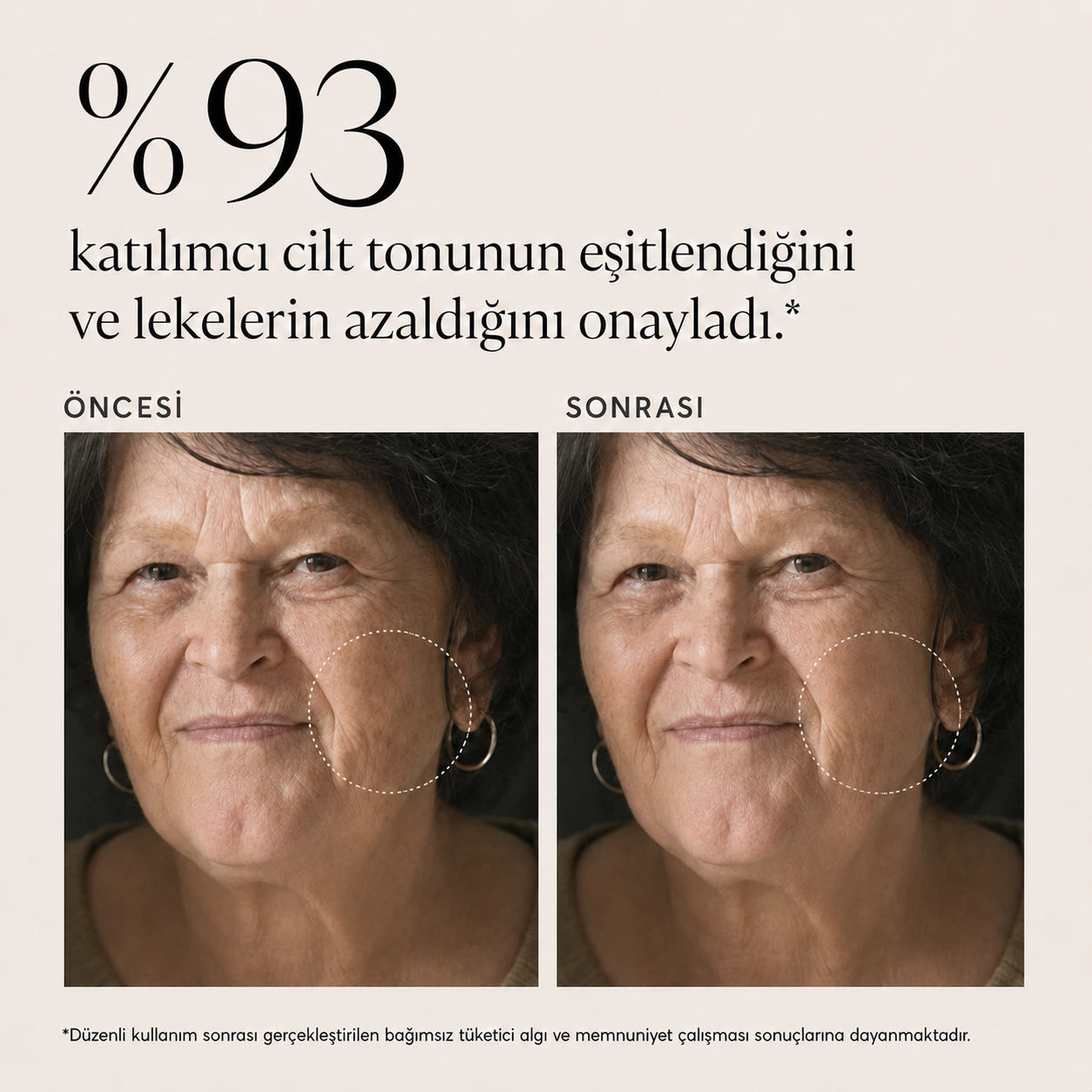 Diamond Retinal 25